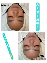 ベルエス(bell.s)/最新施術！！