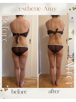 エイミー 藤ヶ丘店(Amy)/before→after