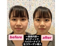 リッカ(Ricca)の雰囲気（驚きのビフォーアフター(#^^#)）