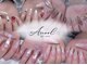 アヌーロ(Anool)の写真