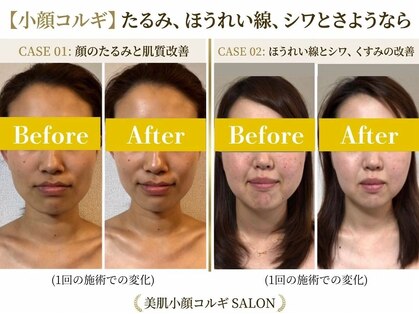小顔コルギサロン シー(She)の写真