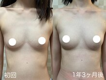 ハレオラ(HaleOla)/お客様の変化☆バストケア