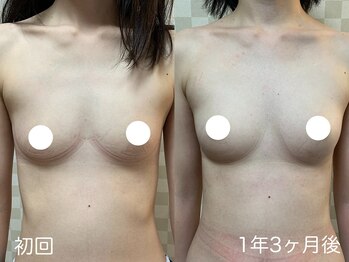 ハレオラ(HaleOla)/お客様の変化☆バストケア