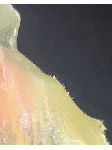 ナナラ(NANALA)/ポツポツ出てる白いの角栓。。。