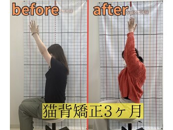 きずな鍼灸整骨院 武蔵ヶ丘本院/猫背矯正