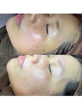 ホワラ 横浜店(Whila)/施術効果3