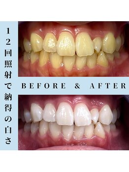 ドルチェ 水戸店(Dolce)/★ before → after ★