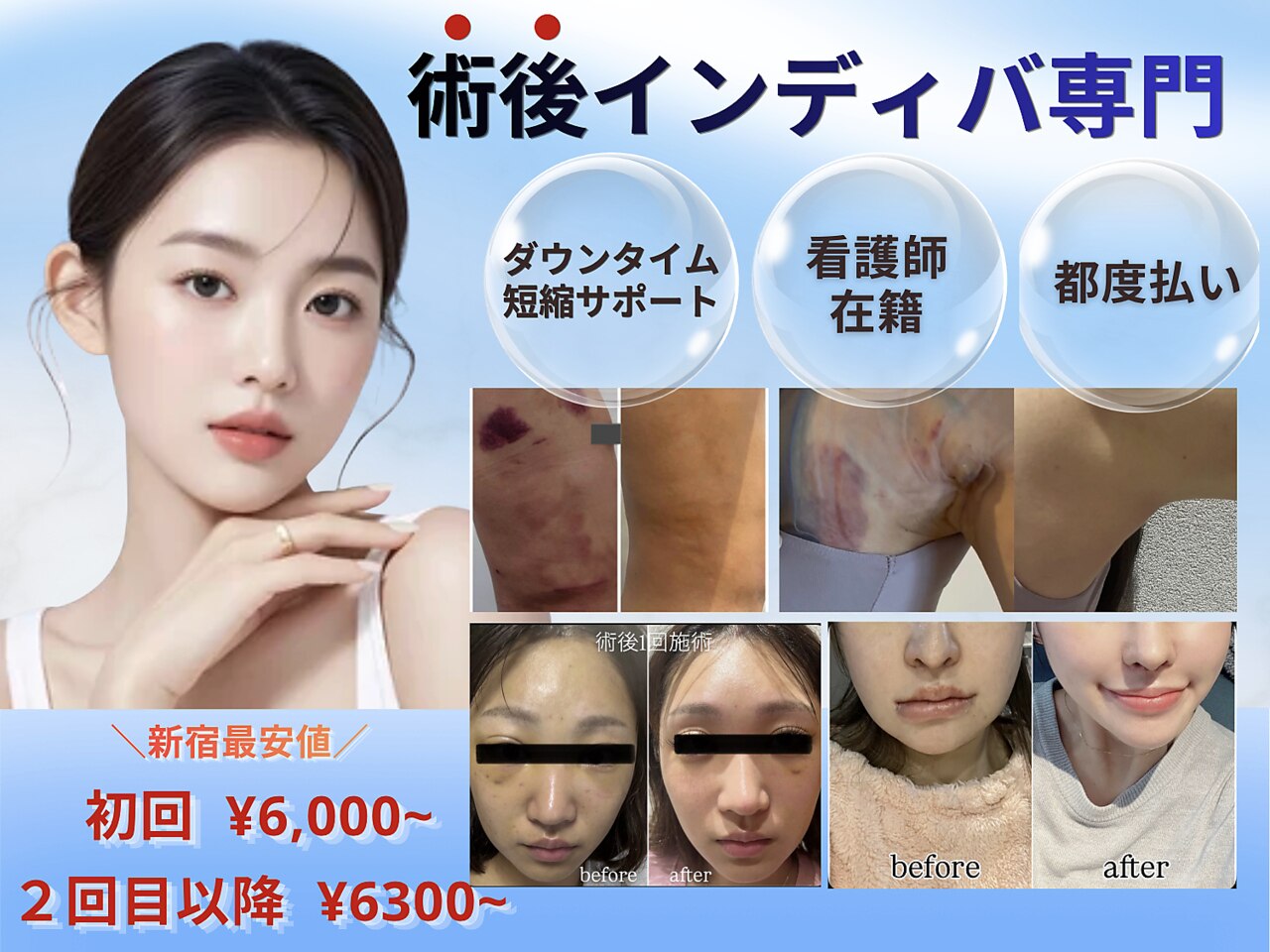 術後インディバ専門サロン 新宿｜ホットペッパービューティー