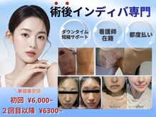 術後インディバ専門サロン 新宿