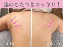 ラジュワード(lajward)の雰囲気(脇もスッキリ!ウエストラインにかけても変わります)