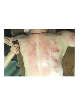 楽楽整体サロン/カッサの後