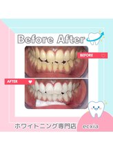 エクシアホワイトニング 札幌琴似店/ナチュラルな白さを手に入れる！