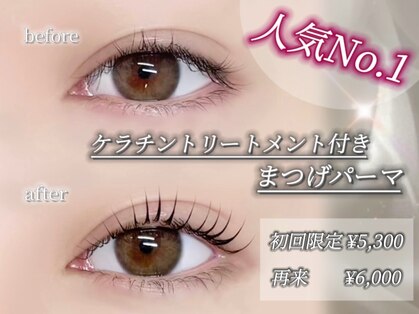 ティンクアイ(Tink eye)の写真