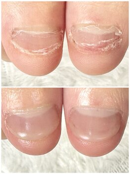 グラシナ 鳥丸店/カラーを楽しみながら矯正