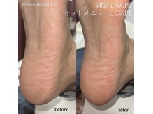 プリンセスローズ(Princess Rose)/かかとの角質ケア☆