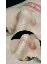 リー ビューティースパ 川崎(Ri beauty spa)/