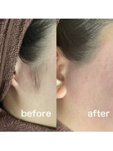 ブラジリアンワックス&光脱毛サロン　　　　　　No.A 恵比寿店【ナンバーエー】/"フェイスワックス"