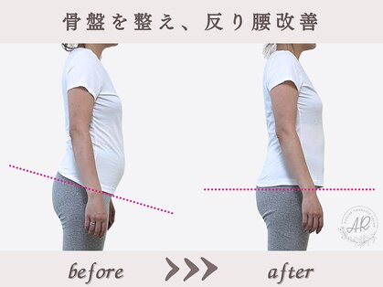 エーアール(AR)の写真