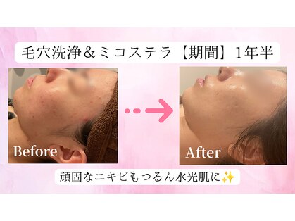 ビダン(bidam)の写真