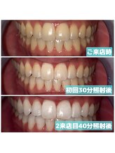 ライトビューティー 関内店(LIGHT BEAUTY)/[ 真っ白な白さをお求めな方へ ]