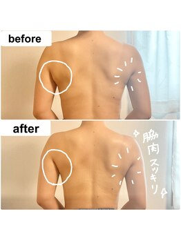 つばききよら/脇肉すっきり！背中美人に♪