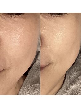 マグノリア(Magnolia)/