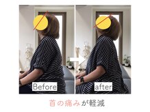 整体あゆむ 立川店/before after7