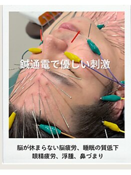 鍼日和/【優しい刺激】電気を流す美容鍼