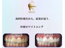 ドクターモック(Dr.MOC)の雰囲気(完全個室!ペアでの施術も可◎)