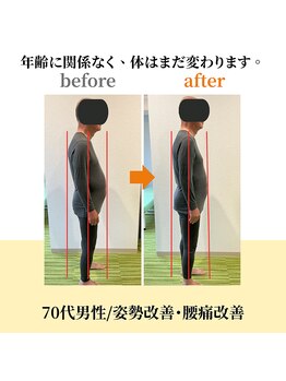 アキ整体(AKI整体)/慢性腰痛・姿勢改善の症例