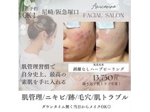 アミーカリーナ 阪急塚口店(Amicarina)