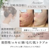 アミーカリーナ 阪急塚口店(Amicarina)