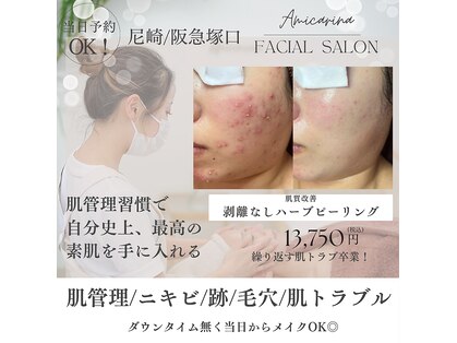 アミーカリーナ 阪急塚口店(Amicarina)の写真