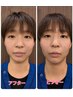 小顔整体　30分　6000円