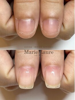 マリーロール 梅田店(Marie Laure)/自爪育成/深爪矯正/ネイルケア