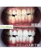 ルブラン 奈良店(Le Blanc)/お顔もパッと明るい印象に♪