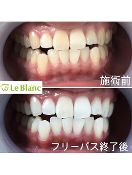 ルブラン 奈良店(Le Blanc)/お顔もパッと明るい印象に♪