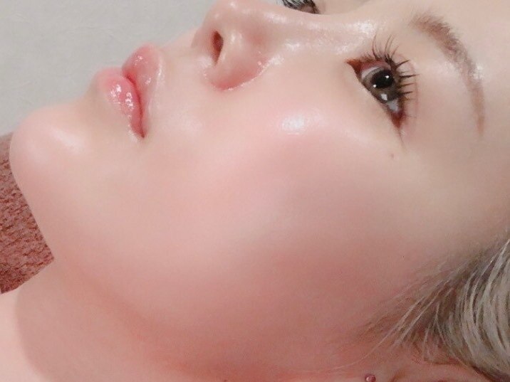 O2toDerm 酸素ドーム 韓国肌管理 白玉肌