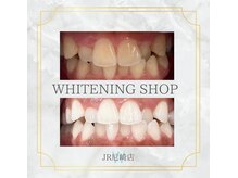ホワイトニングショップ 尼崎店/ホワイトニング