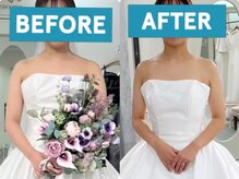 ティアエ(T-ae)/【ブライダルエステ】