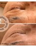 顧客人気NO1★全身ケア込みの満足度高いインディバDETOXフェイシャル120分
