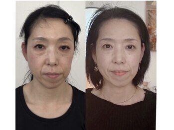 小顔22 ボルティ 本店(Bolty)/お客様