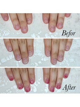 リミズネイルビューティー 名駅店(RimisNailxbeauty)/【美爪育成】深爪・噛み爪改善