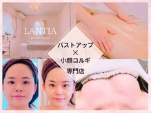 ランティア(LANTIA)