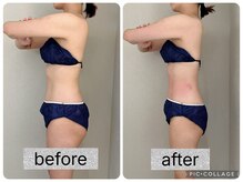 イヨヨ(iyoyo)/【痩身】Before After