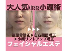 キララ 美容矯正