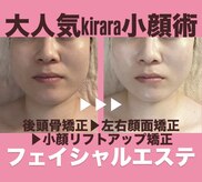 キララ 美容矯正