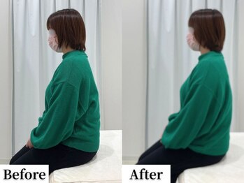 ソレア(Solea)/巻き肩・肩甲骨改善1回目