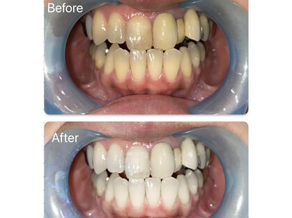 スマイルホワイトの写真