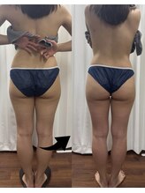 ラサロンホープ 西麻布(La.SALON HOPE)/一回で結果が出る施術